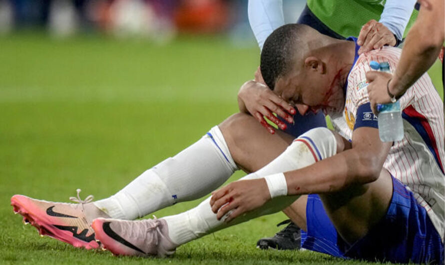Euro 2024 : Réaction de Real Madrid face la blessure de Kylian Mbappé.